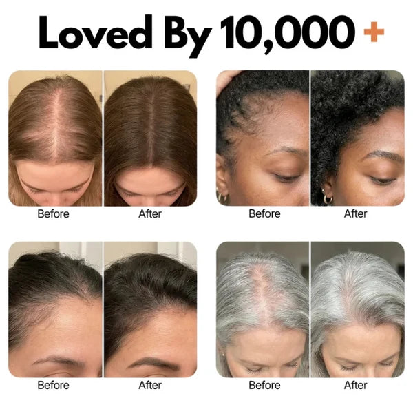 Folliq™  PDRN Root Revival Scalp Serum